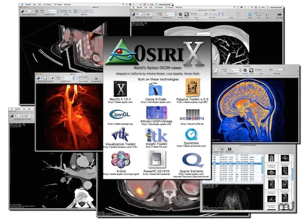 OsiriX For Mac截图