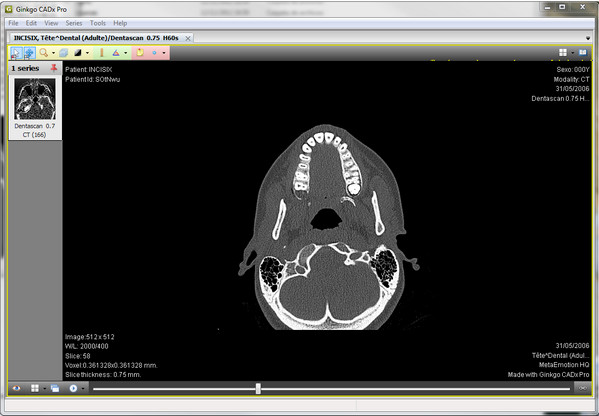 Ginkgo CADx Pro(医学图像浏览)截图
