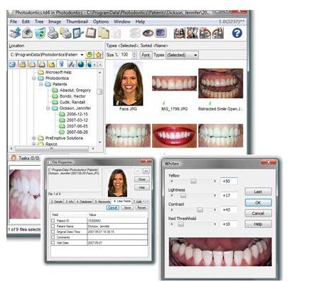Photodontics Pro(牙科图像管理系统)截图