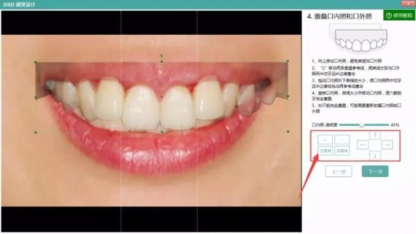 牙医管家口腔管理软件截图