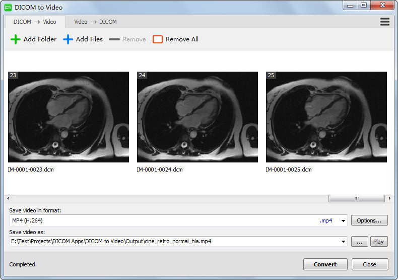 DICOM to Video截图