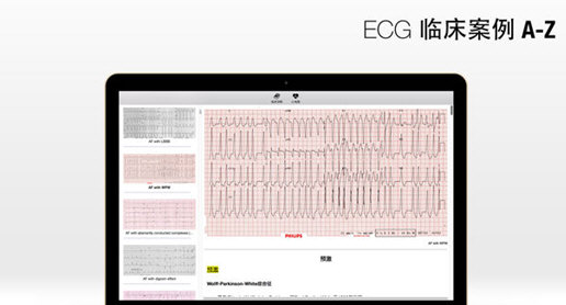 心电图Mac截图