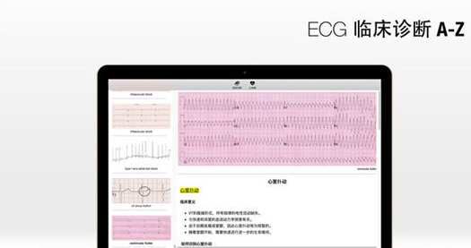 心电图Mac截图