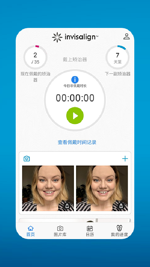 My Invisalign截图